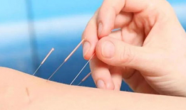 针灸视频,入门到精通的实用指南